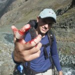 Bloody finger. Photo by Clint Helander.